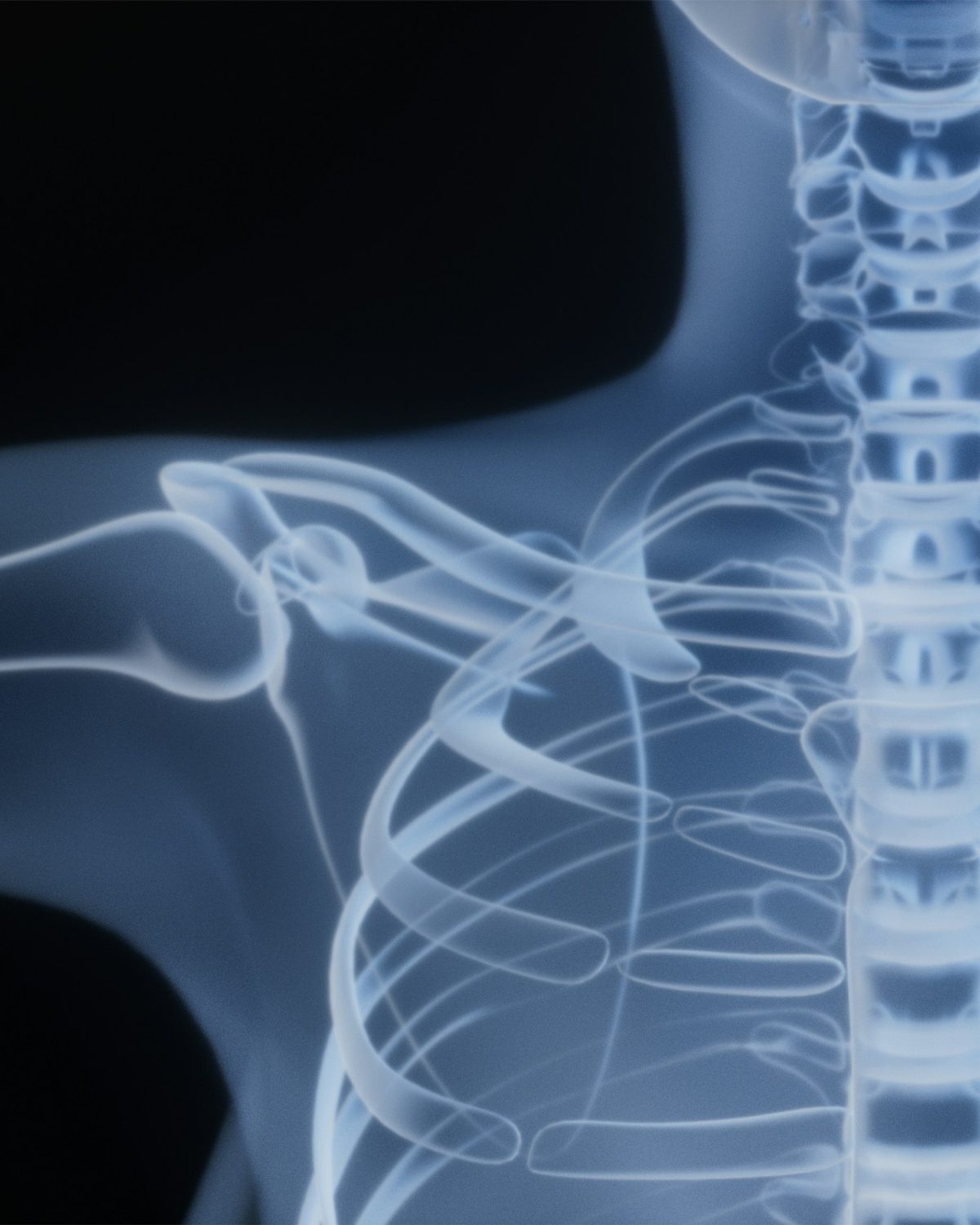 Glowing blue X-ray of a shoulder and upper spine